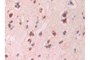 Detection of Ab1-42 in Human Cerebrum Tissue using Monoclonal Antibody to Amyloid Beta Peptide 1-42 (Ab1-42)
