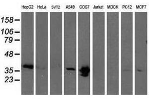 Image no. 2 for anti-Microtubule-Associated Protein, RP/EB Family, Member 2 (MAPRE2) antibody (ABIN1499320) (MAPRE2 anticorps)