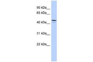 WB Suggested Anti-ENPP6 Antibody Titration: 0. (ENPP6 anticorps  (Middle Region))