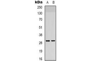 Western blot analysis of ATP5F1 expression in K562 (A), NIH3T3 (B) whole cell lysates. (ATP5F1 anticorps)