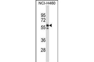 KRT6B Antibody (Center) (ABIN657654 and ABIN2846649) western blot analysis in NCI- cell line lysates (35 μg/lane). (Keratin 6B anticorps  (AA 207-236))