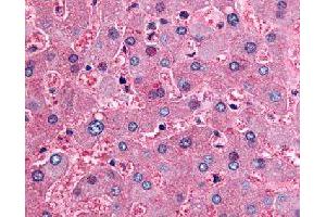 Immunohistochemical (Formalin/PFA-fixed paraffin-embedded sections) staining in human liver with DPP9 polyclonal antibody . (DPP9 anticorps)
