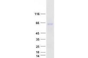 Validation with Western Blot