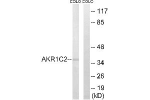 Western blot analysis of extracts from COLO cells, using AKR1C2 antibody. (AKR1C2 anticorps)