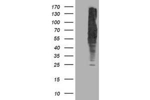 HEK293T cells were transfected with the pCMV6-ENTRY control (Left lane) or pCMV6-ENTRY DLD (Right lane) cDNA for 48 hrs and lysed. (DLD anticorps)