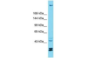 Host: Rabbit Target Name: KIAA1551 Sample Type: ACHN Whole cell lysates Antibody Dilution: 1. (KIAA1551 anticorps  (C-Term))