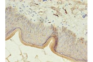 Immunohistochemistry of paraffin-embedded human skin tissue using ABIN7157372 at dilution of 1:100