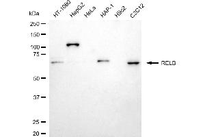 Western blotting analysis using RELB antibody (ABIN7800806).