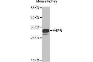 Western blot analysis of extracts of mouse kidney, using M6PR antibody. (M6PR anticorps)