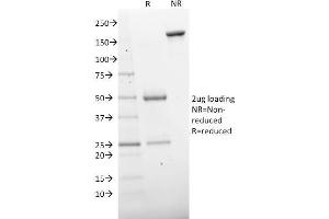 SDS-PAGE Analysis Purified CD73 Mouse Monoclonal Antibody (NT5E/2503).