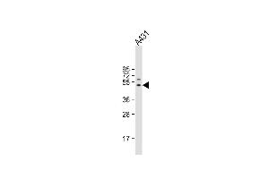 Anti-FIBG Antibody (C-term) at 1:4000 dilution + A431 whole cell lysate Lysates/proteins at 20 μg per lane. (FGG anticorps  (C-Term))