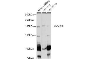 Western blot analysis of extracts of various cell lines, using  antibody (ABIN6127521, ABIN6136573, ABIN6136574 and ABIN6220870) at 1:1000 dilution. (G Protein-Coupled Receptor 116 anticorps  (AA 22-280))