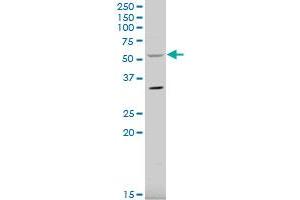 RCBTB2 polyclonal antibody (A01), Lot # 060109JC01 Western Blot analysis of RCBTB2 expression in HeLa .