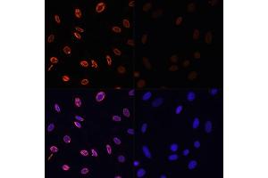 Immunofluorescence analysis of NIH/3T3 cells using Acetyl-Histone H3-K36 antibody (ABIN7267671) at dilution of 1:100.