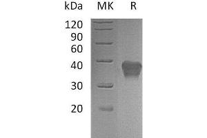 Western Blotting (WB) image for Cytokine Receptor-Like Factor 2 (CRLF2) protein (His tag) (ABIN7320658) (CRLF2 Protein (His tag))