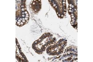 Immunohistochemical staining of human small intestine with KIAA0355 polyclonal antibody  shows cytoplasmic positivity in glandular cells at 1:20-1:50 dilution. (KIAA0355 anticorps)