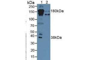 Rabbit Detection antibody from the kit in WB with Positive Control: Sample Lane1: Human Serum; Lane2: Human Liver Tissue. (Complement Factor H Kit ELISA)