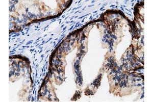 Immunohistochemical staining of paraffin-embedded Human colon tissue using anti-CRYM mouse monoclonal antibody. (CRYM anticorps)