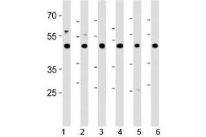 CTBP1 antibody western blot analysis in 1) HeLa, 2) HL-60, 3) Jurkat, 4) Raji cell lines, 5) mouse brain and 6) rat brain tissue lysate.