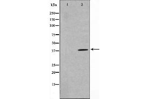 Western blot analysis on HuvEc cell lysate using TNFSF11 Antibody. (RANKL anticorps  (Internal Region))