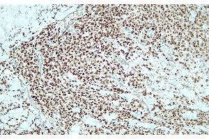 Immunohistochemistry (IHC) image for anti-SRY (Sex Determining Region Y)-Box 10 (SOX10) (C-Term) antibody (ABIN7598799) (SOX10 anticorps  (C-Term))
