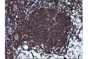 Image no. 8 for anti-RAB37, Member RAS Oncogene Family (RAB37) antibody (ABIN1500561)