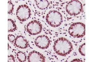 Immunohistochemical analysis of paraffin-embedded human colon, using Phospho-DNA PKcs (S2056) Antibody.