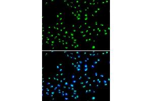 anti-N-Acetyltransferase 10 (GCN5-Related) (NAT10) (AA 1-250) antibody