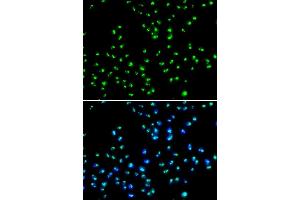 Immunofluorescence analysis of MCF-7 cells using N antibody (ABIN6132968, ABIN6144376, ABIN6144377 and ABIN6223123).