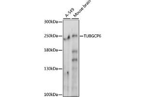 Western blot analysis of extracts of various cell lines, using TUBGCP6 antibody (ABIN7271055) at 1000 dilution. (GCP6 anticorps  (AA 600-900))