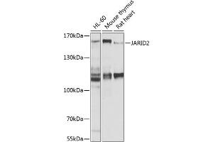 Western blot analysis of extracts of various cell lines, using J antibody (ABIN6129402, ABIN6142653, ABIN6142654 and ABIN6225131) at 1:1000 dilution. (JARID2 anticorps  (AA 1027-1246))