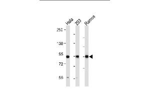 All lanes : Anti-RSK3 Antibody (N-term) at 1:2000 dilution Lane 1: Hela whole cell lysate Lane 2: 293 whole cell lysate Lane 3: Ramos whole cell lysate Lysates/proteins at 20 μg per lane.
