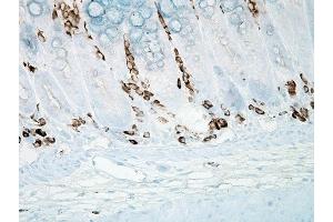 Immunohistochemistry analysis using Mouse Anti-Nitrotyrosine Monoclonal Antibody, Clone 39B6 (ABIN361657 and ABIN361658).