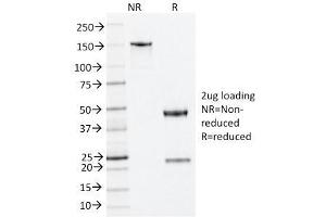 SDS-PAGE Analysis Purified Nucleophosmin Mouse Monoclonal Antibody (NA24).