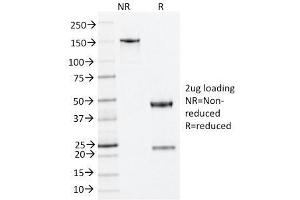 SDS-PAGE Analysis Purified Nucleophosmin Mouse Monoclonal Antibody (NA24). (NPM1 anticorps  (N-Term))