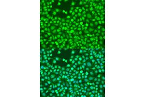 Immunofluorescence analysis of U2OS cells using Smad2 antibody (ABIN4905224) at dilution of 1:100. (SMAD2 anticorps)