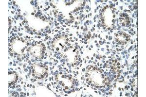 anti-Heterogeneous Nuclear Ribonucleoprotein A/B (HNRNPAB) (C-Term) antibody