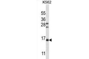 Western Blotting (WB) image for anti-Follicle Stimulating Hormone, beta Polypeptide (FSHB) antibody (ABIN2997110)