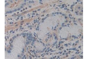 Detection of ACTg2 in Human Stomach Tissue using Polyclonal Antibody to Actin Gamma 2, Smooth Muscle (ACTg2)