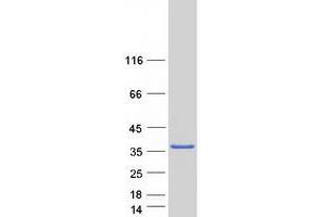 Validation with Western Blot