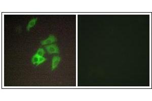 anti-Suppression of Tumorigenicity 14 (ST14) (N-Term) antibody