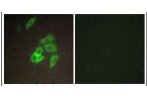 Immunofluorescence analysis of A549 cells, using ST14 Antibody. (ST14 anticorps  (N-Term))