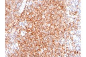 Formalin-fixed, paraffin-embedded human Tonsil stained with CD40 Mouse Monoclonal Antibody (C40/2383).