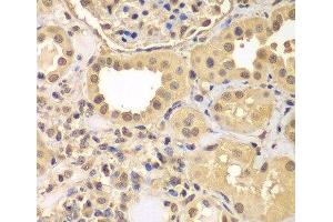 Immunohistochemistry of paraffin-embedded Human kidney using ARNT2 Polyclonal Antibody at dilution of 1:100 (40x lens). (ARNT2 anticorps)