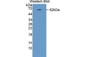 Detection of Recombinant IK, Human using Polyclonal Antibody to IK Cytokine, Down Regulator Of HLA II (IK) (Protein Red (IK) (AA 1-192) anticorps)