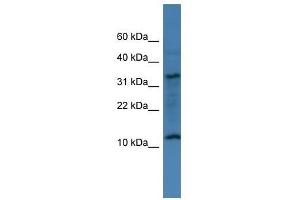Western Blot showing C14orf177 antibody used at a concentration of 1-2 ug/ml to detect its target protein. (C14ORF177 anticorps  (N-Term))