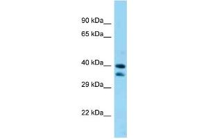 WB Suggested Anti-Sav1 Antibody Titration: 1. (SAV1 anticorps  (C-Term))