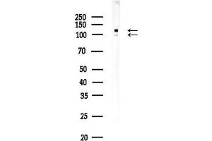 Western blot analysis of lysates from 3-L1 P6(LPS,4h treatment), using GRI Antibody at 1/1000 dilution.