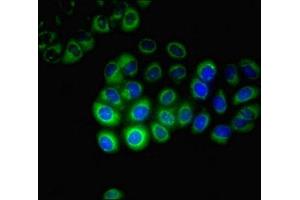 Immunofluorescent analysis of A549 cells using ABIN7170749 at dilution of 1:100 and Alexa Fluor 488-congugated AffiniPure Goat Anti-Rabbit IgG(H+L)