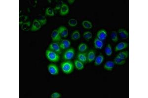 Immunofluorescent analysis of A549 cells using ABIN7170749 at dilution of 1:100 and Alexa Fluor 488-congugated AffiniPure Goat Anti-Rabbit IgG(H+L) (CYP17A1 anticorps  (AA 1-508))